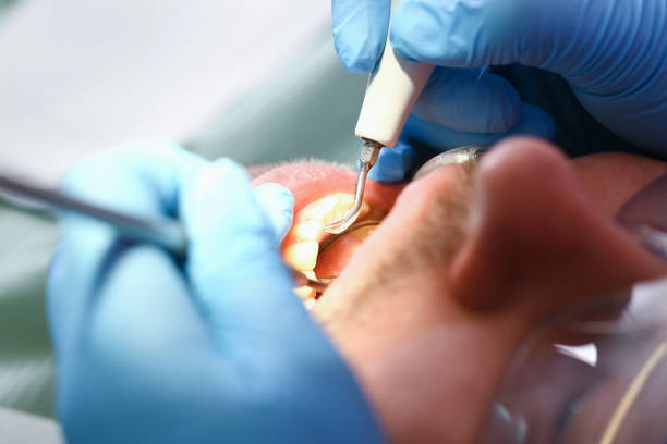 Best Emergency Tooth Extraction in Hearne, TX
