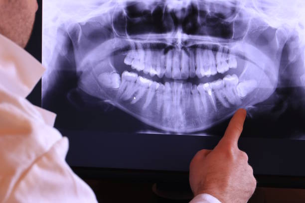 Best Emergency Treatment for Toothache in Hearne, TX